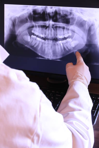 Best Chipped Tooth Repair Near Me  in Macedonia, OH